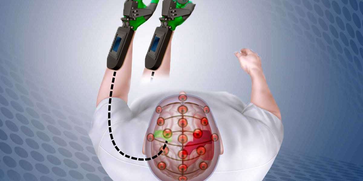 Neuroprosthetics Market Size is expected to reach USD 21.5 billion by 2030