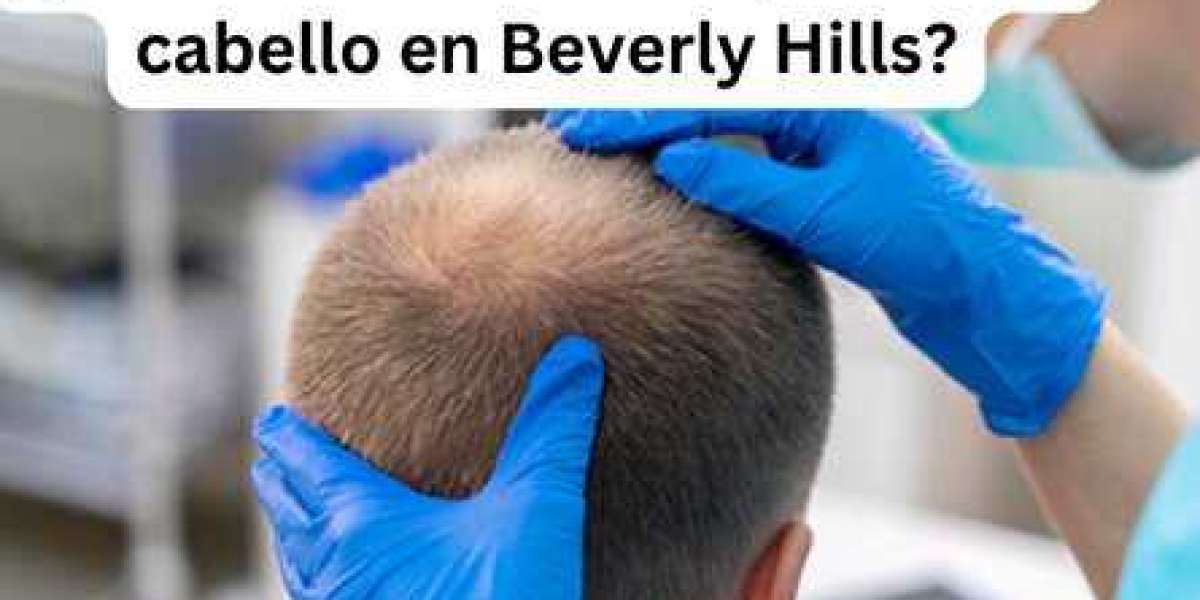 ¿Cuánto cuesta el trasplante de cabello en Beverly Hills?