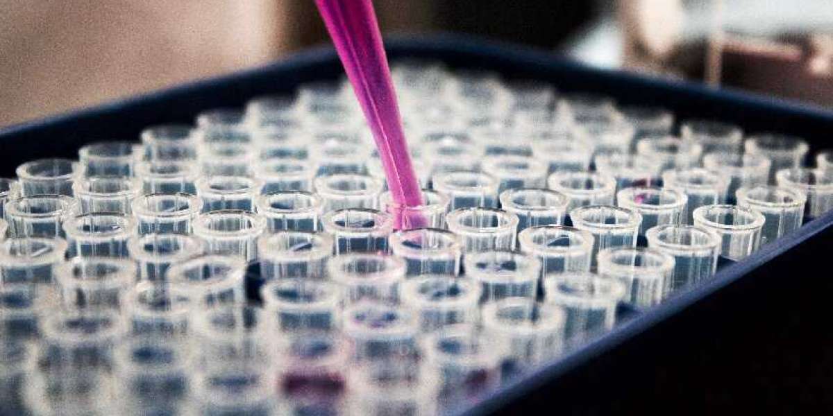 Guide to isothermal titration calorimetry